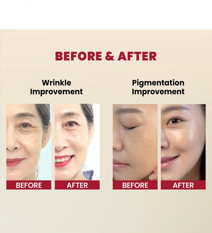 KSECRET - SEOUL 1988 Serum : Retinal Liposome 2% + Black Ginseng